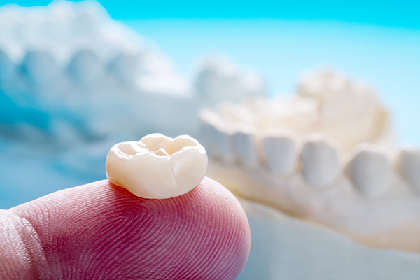 What Is a Dental Crown?