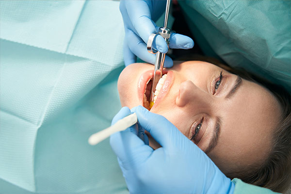 Why Choose Composite Fillings?
