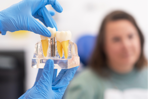 Serene Dental Center Dental Implants