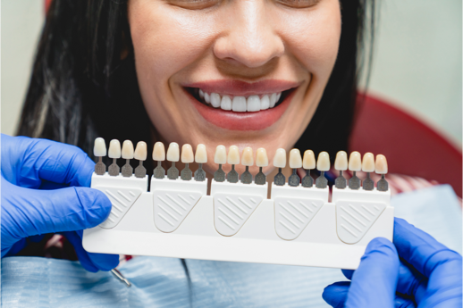 Serene Dental Center Porcelain Veneers
